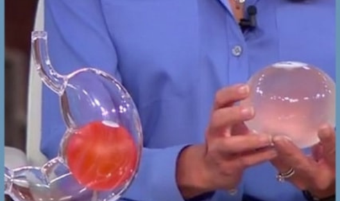 gastric balloon price